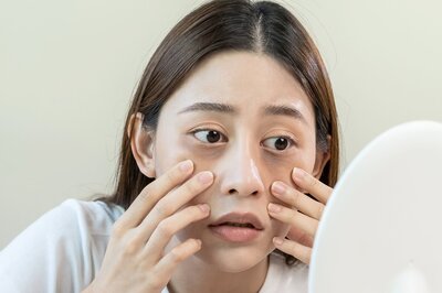Skin Expert Decodes Reasons for Acne on a Particular Spot