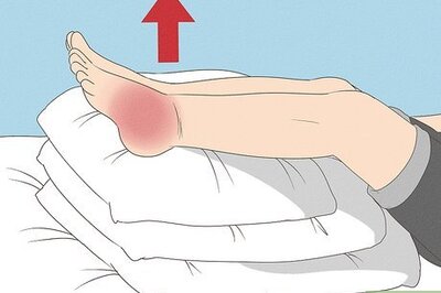 How to Treat Swelling