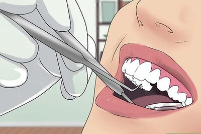 What Are Bunny Teeth? Are They Attractive?