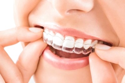 8 Ways to Prevent Tooth Decay and Cavities