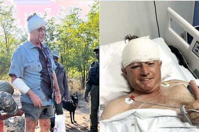 Former International Cricketer Cheats Death Surviving a Horrific Leopard Attack; Bloody Images Emerge