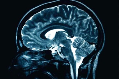 Brain stimulation technique could reduce anorexia symptoms: Study