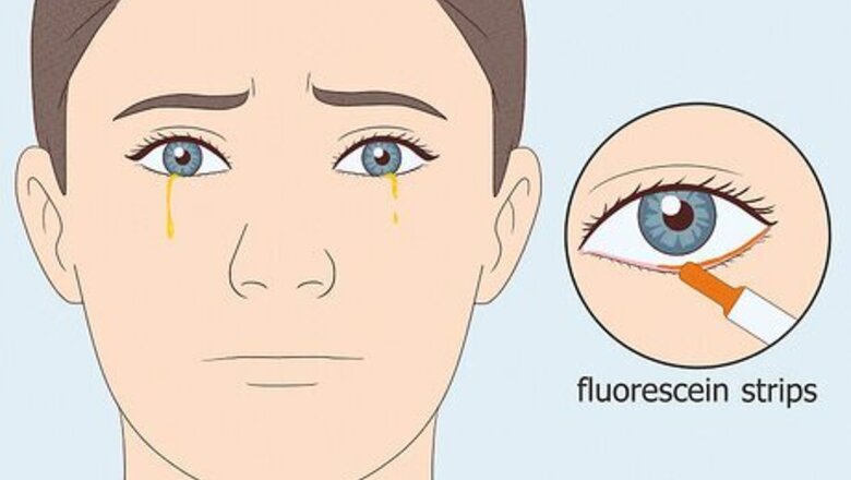 What Causes Yellow Tears? The Viral TikTok Video Explained