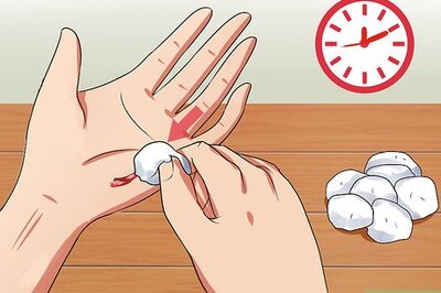 How to Treat Small Cuts or Scratches