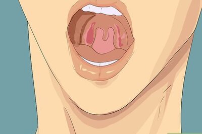 How to Fake Strep Throat