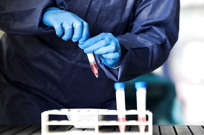 BSVL to Conduct Trials on Severe Sepsis Drug in Covid-19 Patients With ARDS