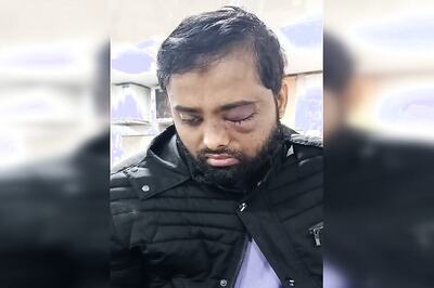 Jamia Student Has Lost One Eye, Says Varsity Proctor, Lawyer Claims AMU Student’s Right Hand Amputated