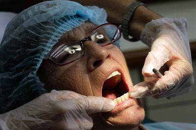 Oestrogen Therapy May Get Your Teeth, Gums Healthier