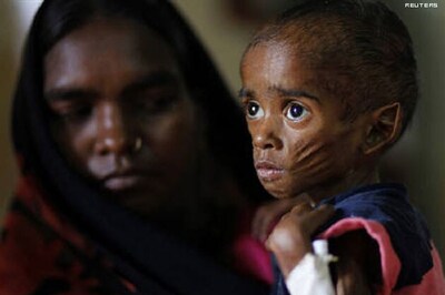 Join hands to end malnutrition in Gujarat: CM Anandi Patel's Independence Day appeal