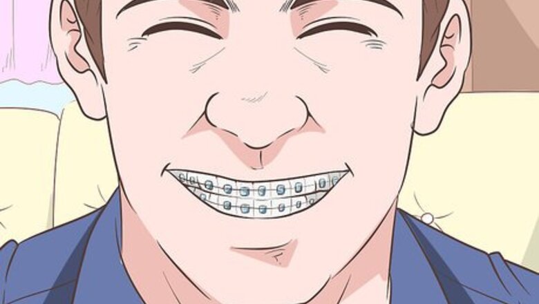 How to Look Good in Ceramic Braces