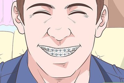 How to Look Good in Ceramic Braces