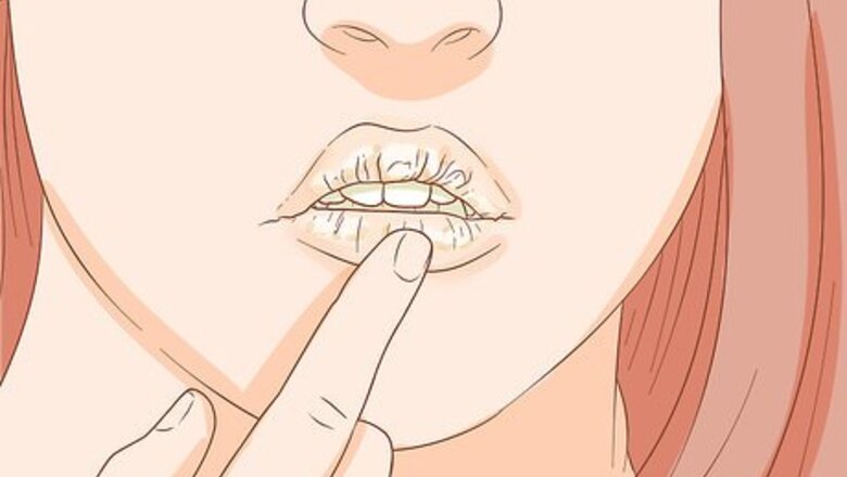 How to Unclog a Salivary Duct