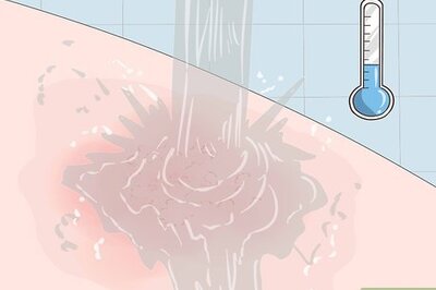 How to Wash Off Poison Ivy