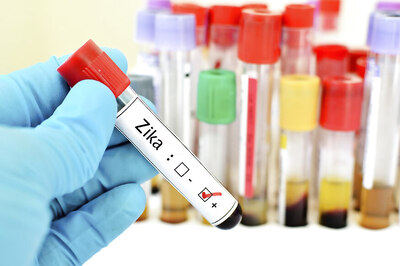 Is Vaccination against Zika Advisable for Women of Childbearing Age?