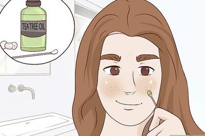How to Get Rid of Blackheads Naturally
