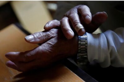 UP: Man Bites Shopkeeper's Finger Over Rs 50 Dispute, Case Filed