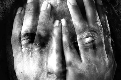 Siblings Throw Acid on Woman, Her 3 Kids over Property Dispute in Gujarat