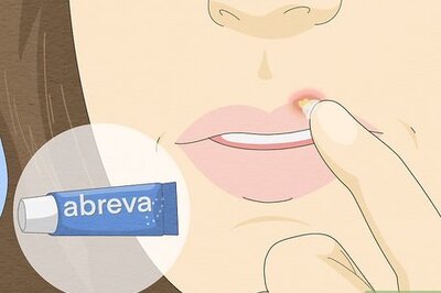 How to Get Rid of a Cold Sore Fast