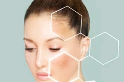 Bid Adieu to Hyperpigmentation With These 5 Ways