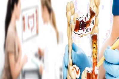 Uttarakhand Researchers To Study Use of Medicinal Herbs For Treatment of Colon Cancer