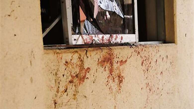 Child injured in crude bomb explosion
