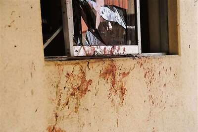 Child injured in crude bomb explosion