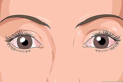 How to Get Rid of Pink Eye Fast