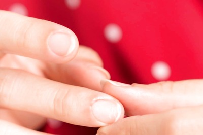 5 Signs of Iron Deficiency on Skin, Hair and Nails