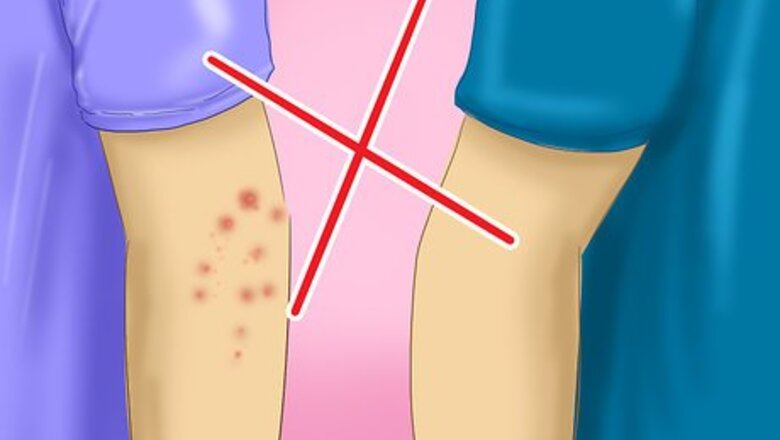 How to Prevent Scabies