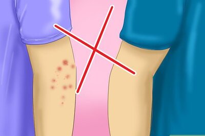 How to Prevent Scabies