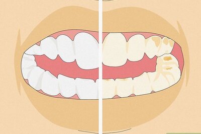 How to Recognize Tooth Enamel Loss