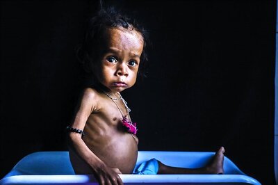 One in Three Young Children Either Undernourished or Overweight: UNICEF Report