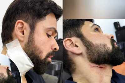 Emraan Hashmi's Gruesome Injury on Goodachari 2 Sets Leaves Fans Shocked; Photos Go Viral