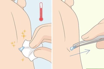 How to Get Glass out of Your Foot