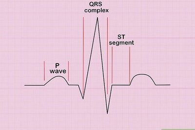 How to Calculate Heart Rate from ECG