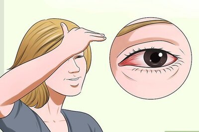 How to Treat Pink Eye (Conjunctivitis)