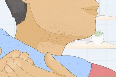 How to Get Rid of Razor Bumps on Your Neck