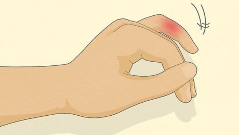 All About Smartphone Pinky: What It Is & How to Treat It