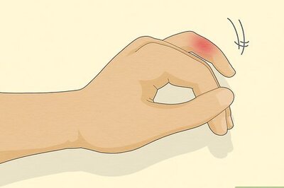 All About Smartphone Pinky: What It Is & How to Treat It