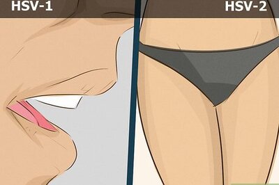 How to Date a Girl With Herpes