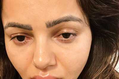 Rubina Dilaik Leaves Fans Worried As She Posts Pics With Swollen Face, Lips; Calls Herself 'A Duck'