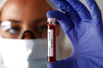 Blood Group O Likely to Have Lower Risk of Coronavirus Infection, Says Study