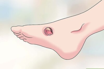 How to Cure Jungle Rot