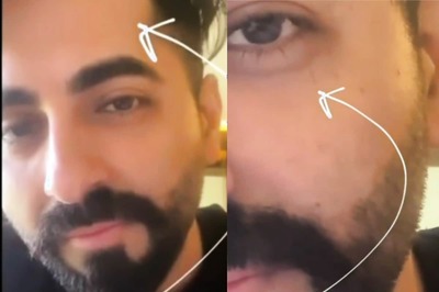 Ayushmann Khurrana Wonders What to Wish on His Broken Eyelash, Says He Got What He Wanted