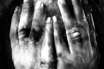 West Bengal Man Throws Acid on Niece After She Refused His Indecent Proposal