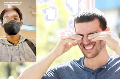 Malaysian Man's Habit Of Eye Rubbing Damages His Cornea, Gets Transplant Done