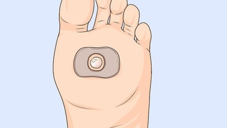 How to Heal Blisters Fast
