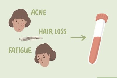 How to Reduce Androgens