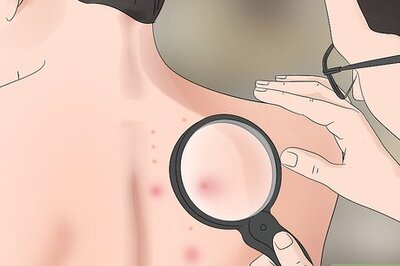 How to Kill a Hornet Nest