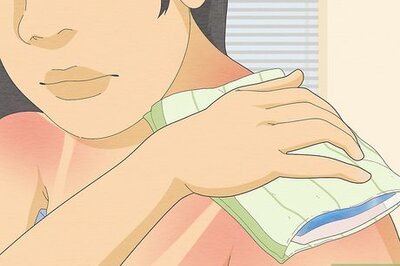 How to Get Relief from an Itchy Sunburn